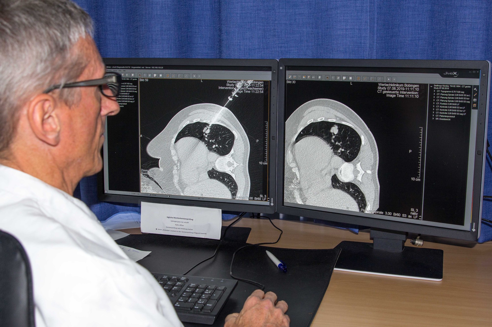 Der Radiologe Dr. Egbert Knöpﬂe zeigt auf einem Computerbildschirm die Computertomographie-Aufnahmen während einer Biopsie. Foto: Doris Wiedemann